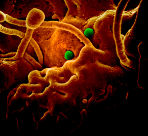 image of the virus
