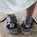 Feet affected by leprosy and covered with protective shoes.