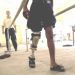 Man affected by leprosy walking while undergoing physical therapy.