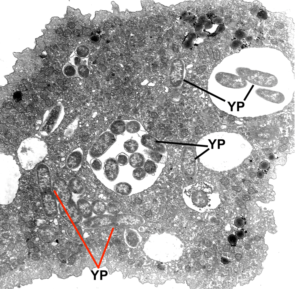 microscopy image of plague