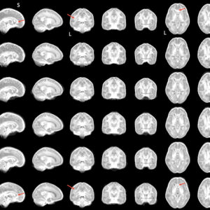 Brain Images